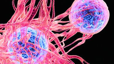 لمعرفة كيفية انتشاره في الجاذبية الصغرى..إرسال خلايا سرطانية إلى الفضاء