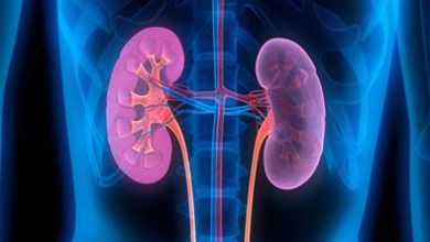 نصائح لمرضي الكلى