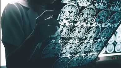 علماء يكتشفون طريقة جديدة لمحاربة داء ألزهايمر